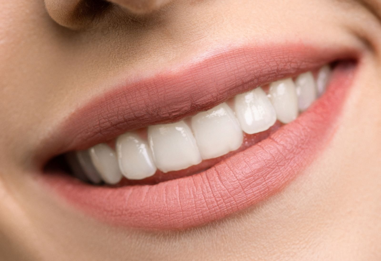 Blanqueamiento en Villa Dental