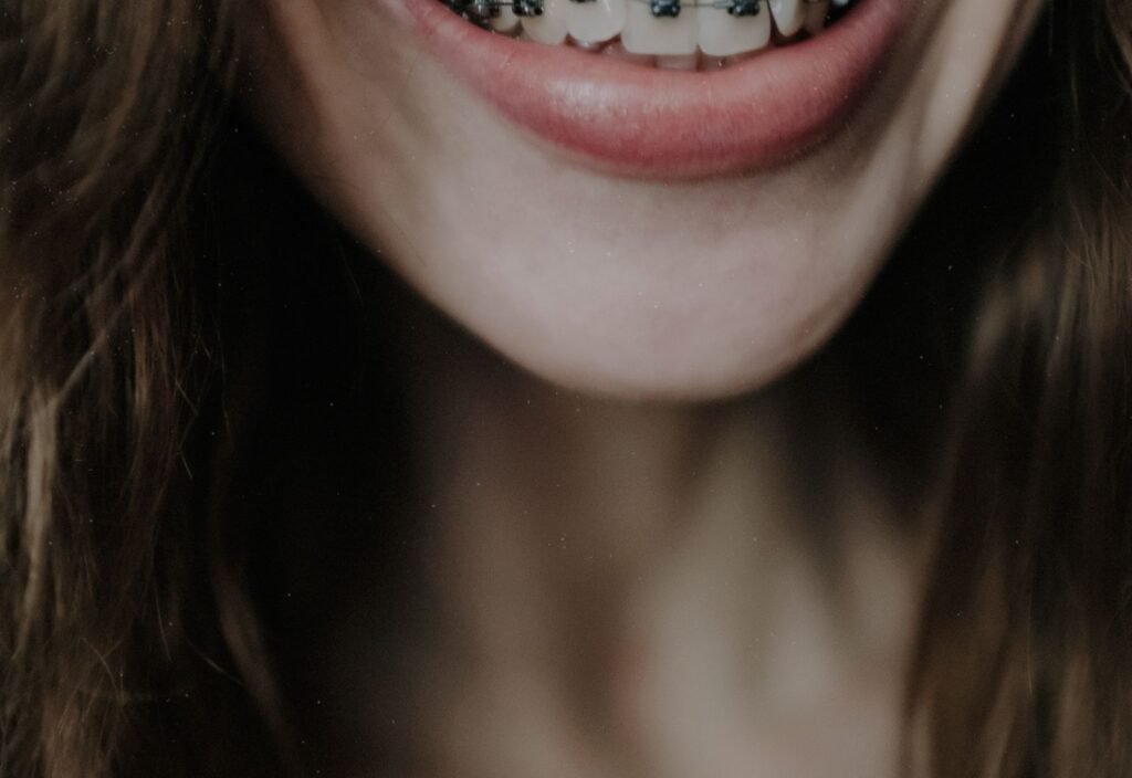 Ortodoncia para adultos y adolescentes: brackets o alineadores